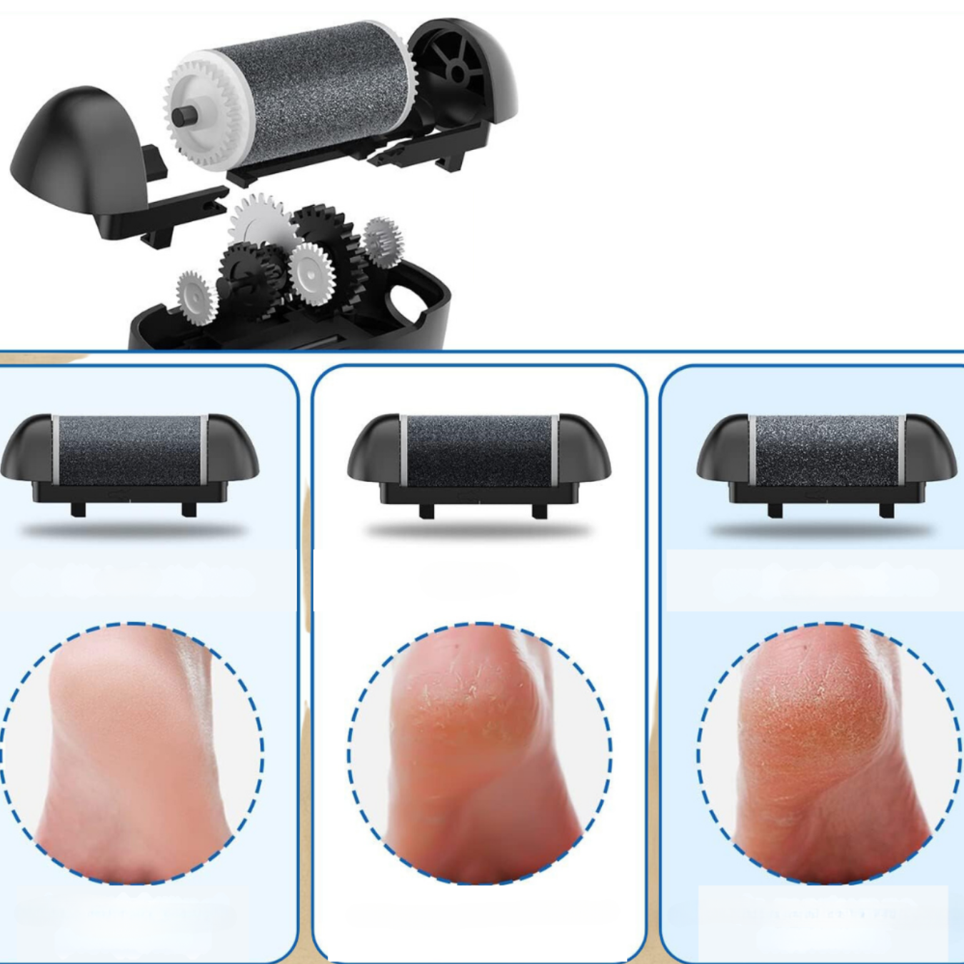 Summy Electric Foot File for Gentle Home Pedicure Care