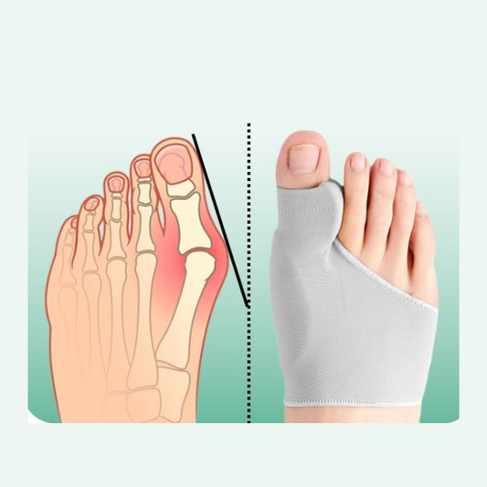 Hallux Corract Set - Pain Relief & Foot Comfort