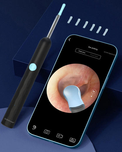 Ravision Pro Ear Camera with Light - Hygienic App Solution