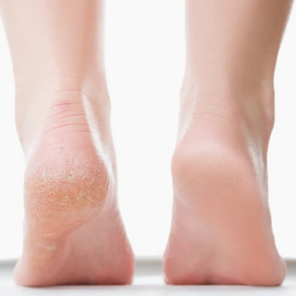 Softstep Electric Foot File for Smooth, Well-Groomed Feet