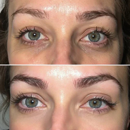 Refreshing Eye Patches for Hydrated, Fresher-Looking Skin
