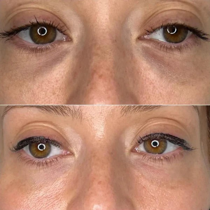 Refreshing Eye Patches for Hydrated, Fresher-Looking Skin