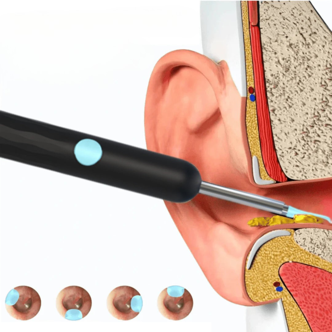 Ravision Pro Ear Camera with Light - Hygienic App Solution