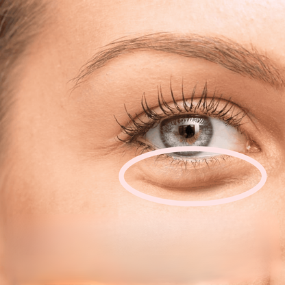 Eyeglow Rejuvenating Red Light Therapy for Brightening Eye Area